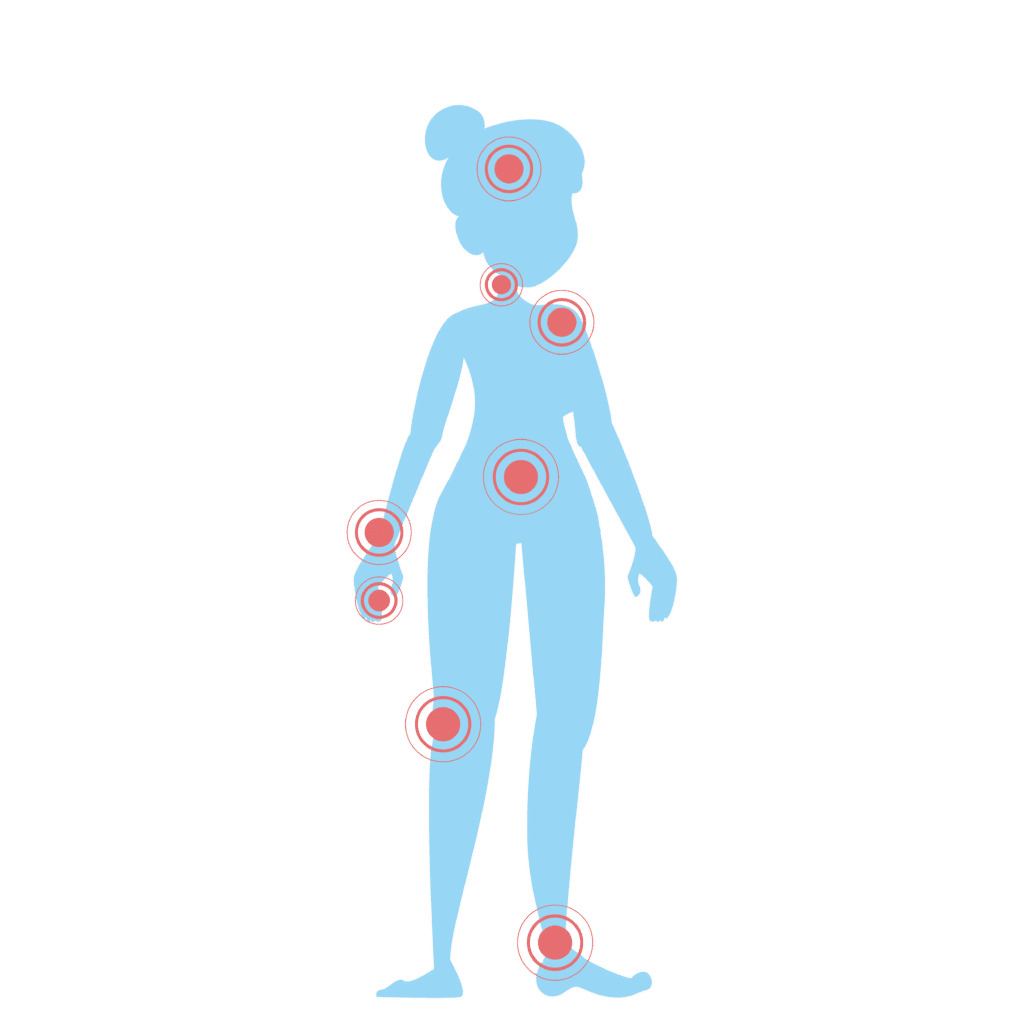 silhouette d'une femme avec des douleurs neuropathiques à plusieurs endroits du corps