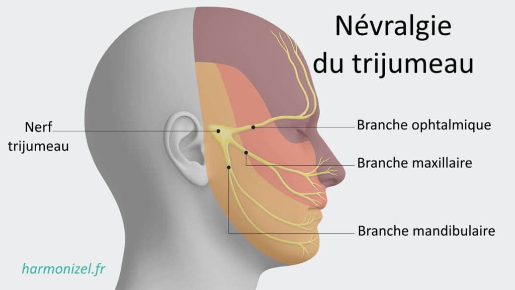 Zones du visage innervées par les 3 branches du nerf trijumeau